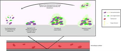 Antibiotic lock solutions as adjunct therapy for catheter-related blood stream infections in pediatric hemodialysis patients